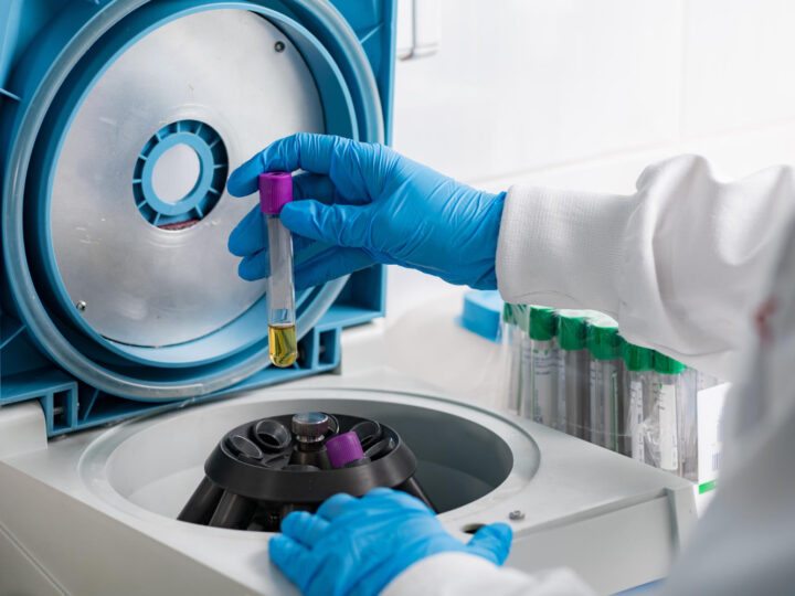 Manutenção preventiva em centrífugas de laboratório: o que você precisa saber