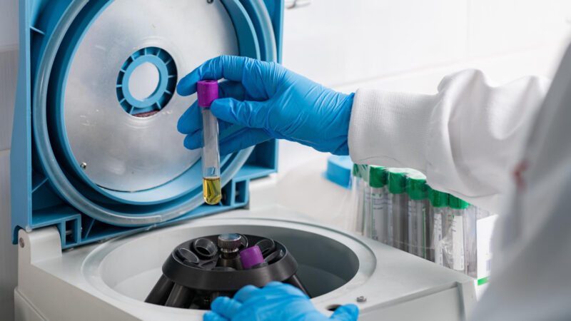 Manutenção preventiva em centrífugas de laboratório: o que você precisa saber